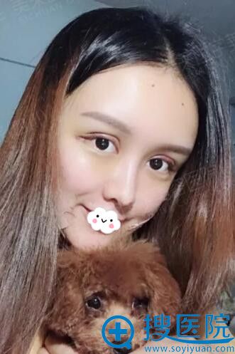 四川重庆美莱医学美容医院雷状整形案例 四川重庆美莱医学美容医院雷状整形案例