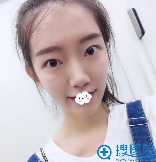下巴整形哪里好?武汉新致美案例 下巴整形哪里好?武汉新致美案例