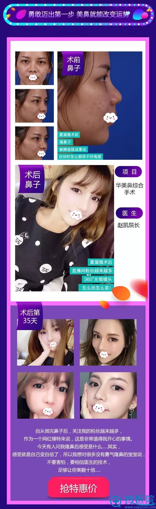 <!--<i data=20240710 data-id=12107></i>-->整形美容医院隆鼻案例 <!--<i data=20240710 data-id=12107></i>-->整形美容医院隆鼻案例