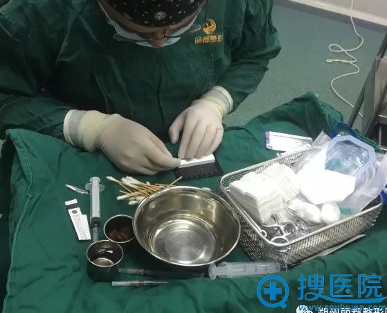 王新灿鼻综合手术过程之术前准备 王新灿鼻综合手术过程之术前准备