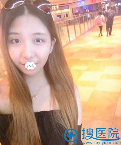 重庆军美医疗美容门诊双眼皮术前 重庆军美医疗美容门诊双眼皮术前