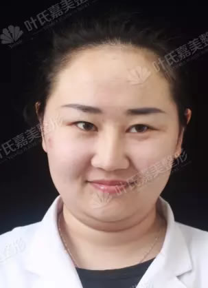 找了许久才找到桂林叶氏嘉美改成的桂林星范做了线雕瘦双下巴