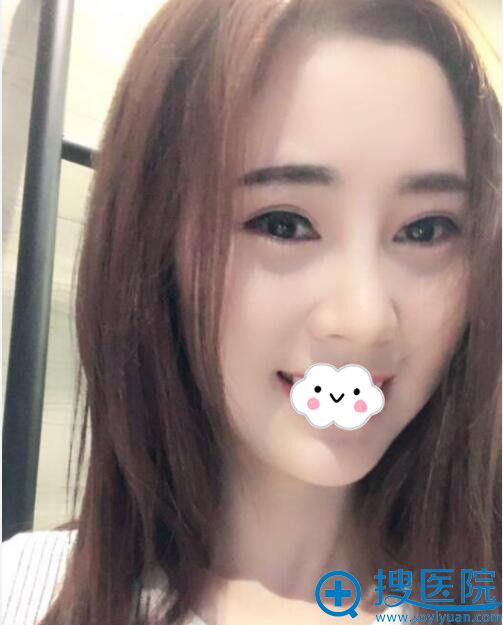 ������������ҽԺ˫��Ƥ����1����Ч��