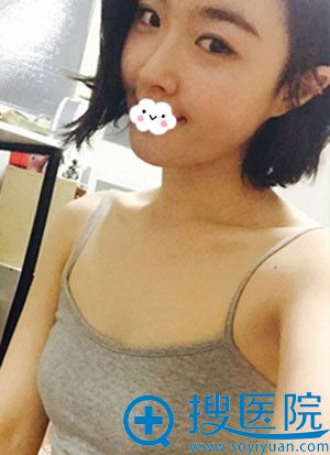 青海西宁康华做假体隆胸好吗?看案例我是如何变身C杯性感女王