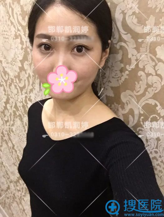 手术前被老公嘲笑的桃子胸 手术前被老公嘲笑的桃子胸