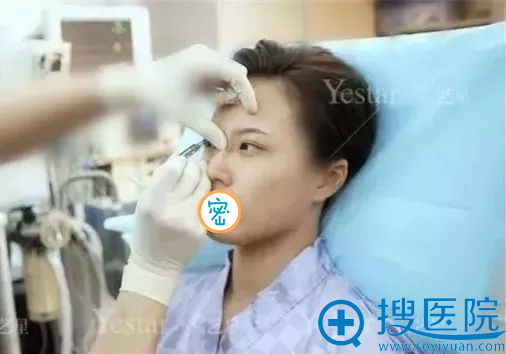 艺星医生进行术前设计 艺星医生进行术前设计