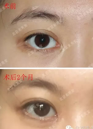�޸����ζ�ʧ��ѡ�񱱾���������������۽��޸����ڳɹ���