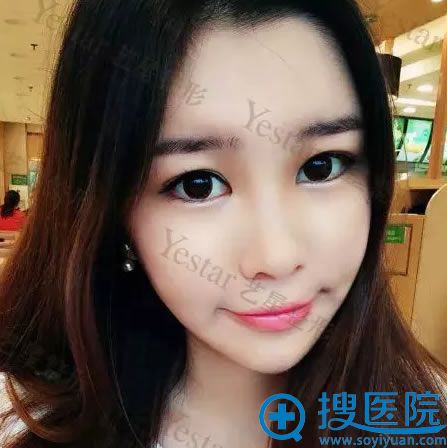 在北京叶子和艺星间选择艺星脂肪填充经历 在北京叶子和艺星间选择艺星脂肪填充经历