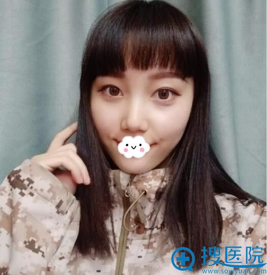 <!--<i data=20240710 data-id=9745></i>-->医疗美容门诊部填充苹果肌案例 <!--<i data=20240710 data-id=9745></i>-->医疗美容门诊部填充苹果肌案例