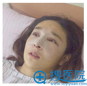 想要鼻子翘翘的就学我找大连新华美天王大太做个鼻综合隆鼻子吧