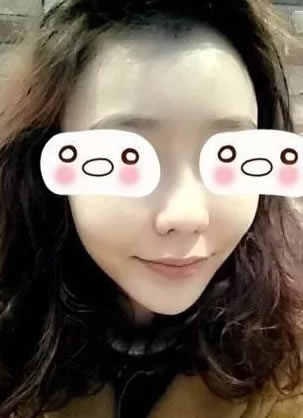 济宁名美和韩美之间选择韩美宋成面部脂肪填充和玻尿酸隆鼻术