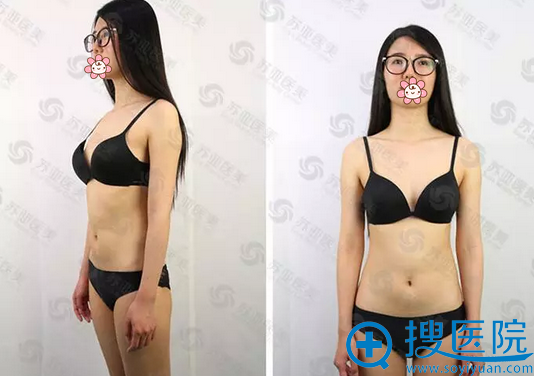 手术钱拍摄术前照 手术钱拍摄术前照