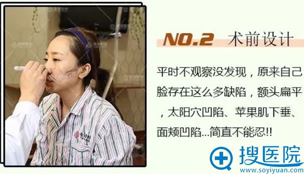 青岛壹美魏邦敏设计自体脂肪填充方案 青岛壹美魏邦敏设计自体脂肪填充方案