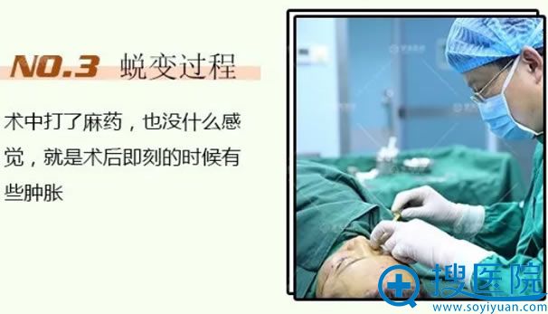 青岛魏邦敏做自体脂肪填充术过程 青岛魏邦敏做自体脂肪填充术过程
