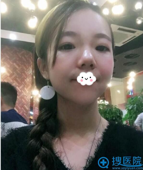 �人������ҽ������ҽԺ������¡��+���°�Ч��