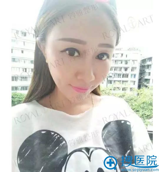 ����֬�����ȫ�沿24��ָ�Ч��