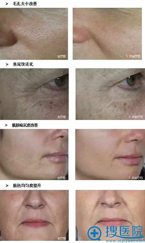 青春动能素真人案例效果 青春动能素真人案例效果