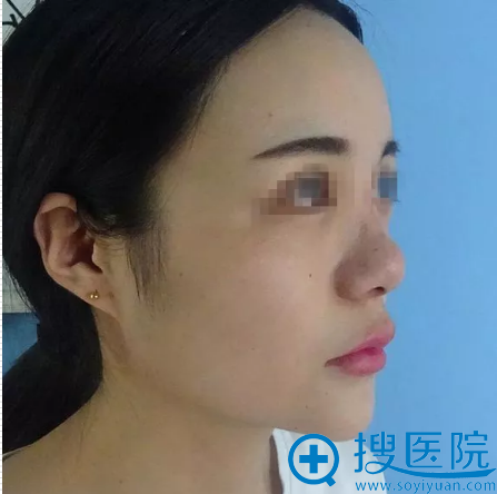 �ҿ������ڹ�����������¡��Ч��������������Ҳ�����˸����ۺ�