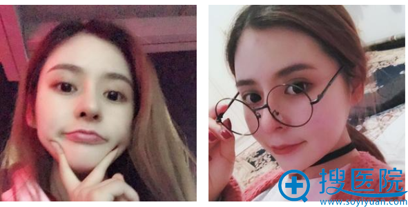 ���ǲ������ܽ��������¡��1���µ���Ƭ