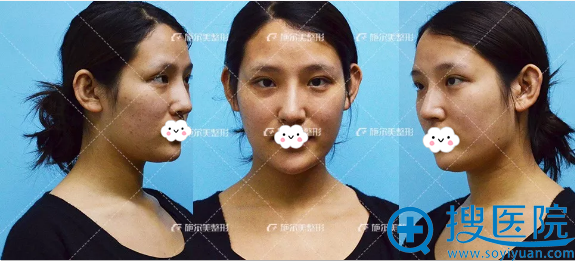 �ҵ����������� �Ͼ�ʩ������ͮͮ�沿֬��������ܾ�������