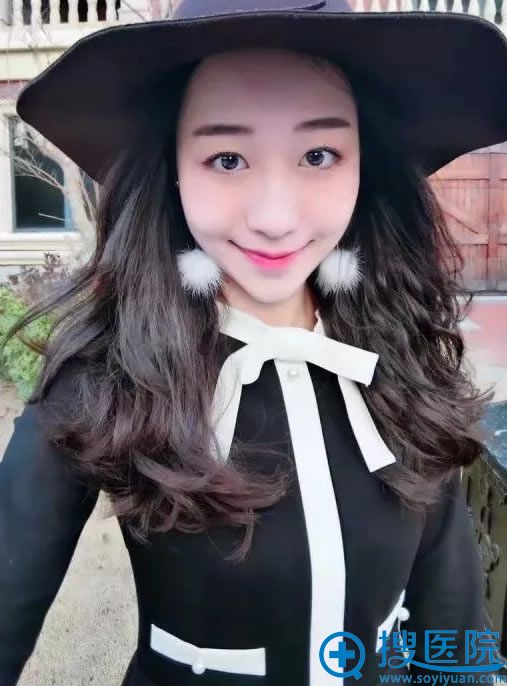 烟台壹美注射11天恢复效果 烟台壹美注射11天恢复效果