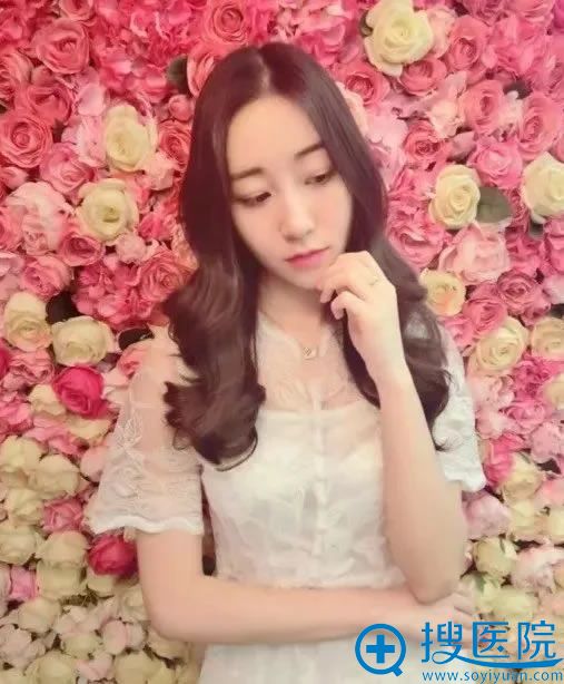 在烟台壹美注射45天恢复照 在烟台壹美注射45天恢复照