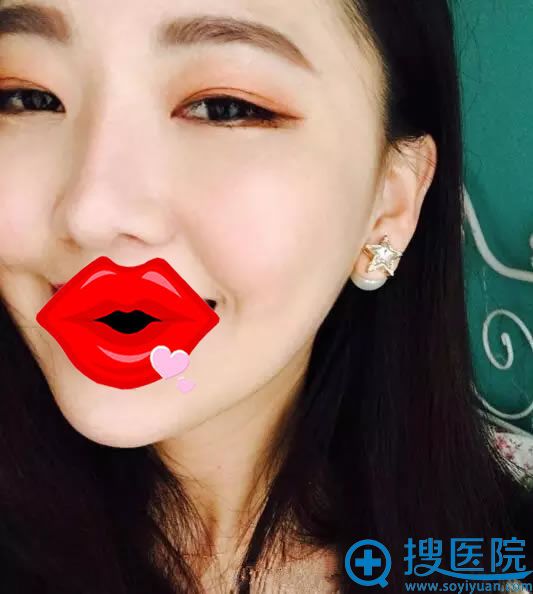 ������˫��Ƥ�����ָ�Ч��ͼ