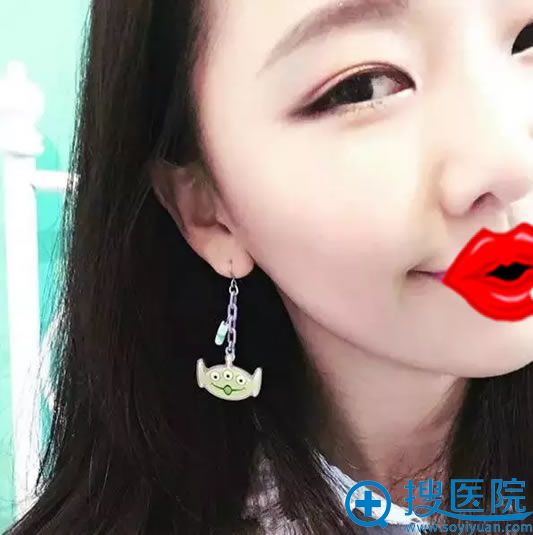 6mm����˫��Ƥ�ָ���Ч��