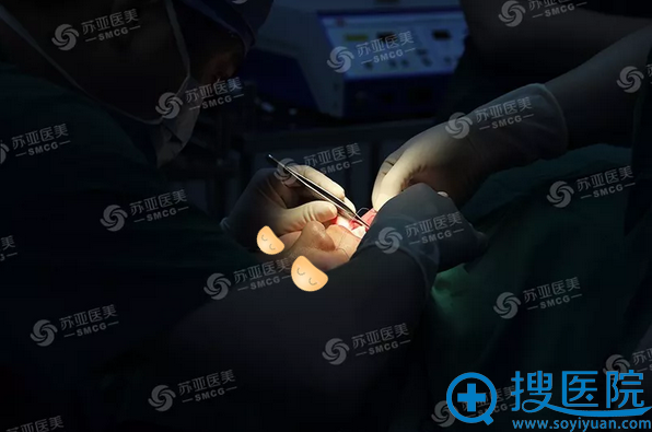 精细缝合口腔内小切口 精细缝合口腔内小切口