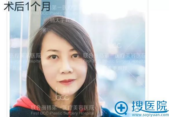 联合丽格杨大平院长面部抗衰案例 联合丽格杨大平院长面部抗衰案例