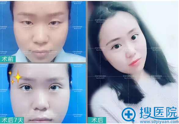 ֣�ݶ�������ҽԺ˫��Ƥ7�참���Ա�ͼ