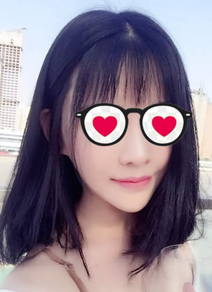北京莫琳娜兰文贤医生鼻综合修复案例 平凡女孩晋升混血范女神