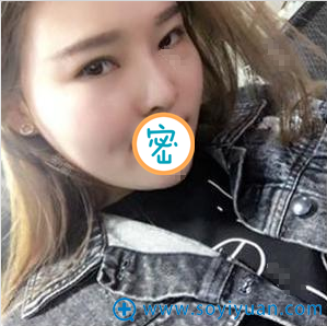 �轺����¡������һ���»ָ���
