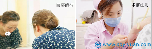 祛眼袋+脂肪填充术前准备 祛眼袋+脂肪填充术前准备