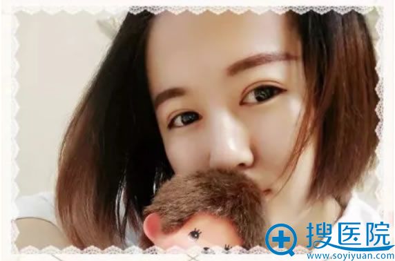 金华丽都做双眼皮和开眼角7天效果 金华丽都做双眼皮和开眼角7天效果