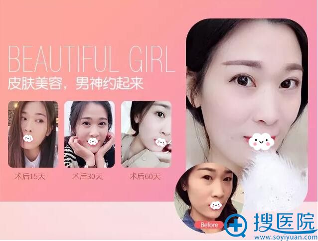 太原时光皮肤美容效果对比 太原时光皮肤美容效果对比