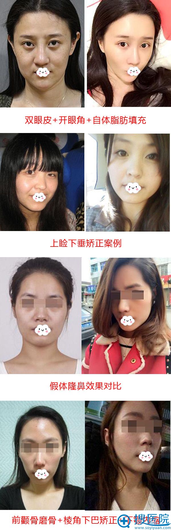 真美啦整形案例真实效果对比 真美啦整形案例真实效果对比