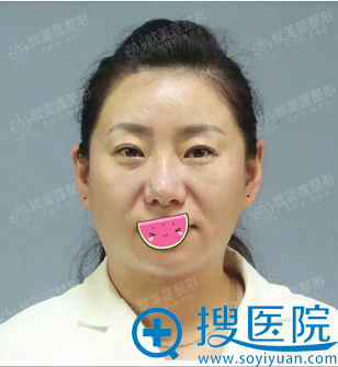 当衰老不期而至 她选择太原欧美莲白立明面部线雕术重塑青春