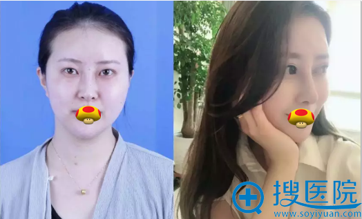 �ൺ�������Ⱥ���ۺ���ǰ����Ա�