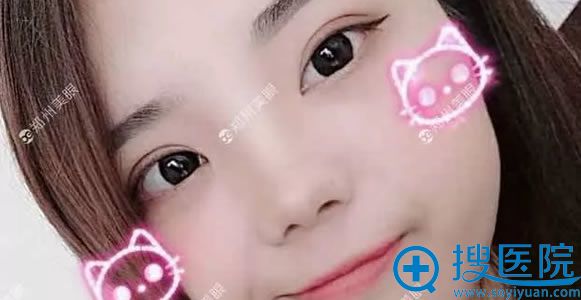 <!--<i data=20240710 data-id=12686></i>--><!--<i data=20240710 data-id=16640></i>-->开眼角案例10个月效果 <!--<i data=20240710 data-id=12686></i>--><!--<i data=20240710 data-id=16640></i>-->开眼角案例10个月效果