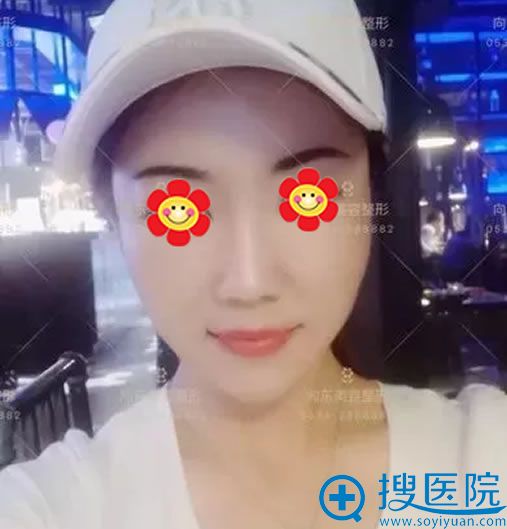 �沿֬�����10���ָ�Ч��