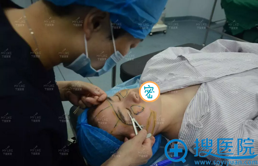 宁波美莱喻正虹双眼皮手术中 宁波美莱喻正虹双眼皮手术中