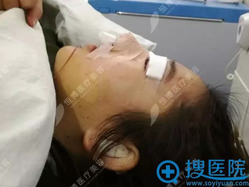 鼻子和眼睛都做完了效果 鼻子和眼睛都做完了效果