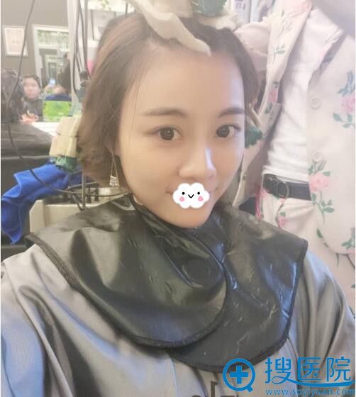 重庆联合丽格面部填充术后效果 重庆联合丽格面部填充术后效果
