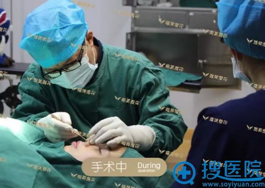 熠美杨孟根院长肋软骨隆鼻手术过程 熠美杨孟根院长肋软骨隆鼻手术过程