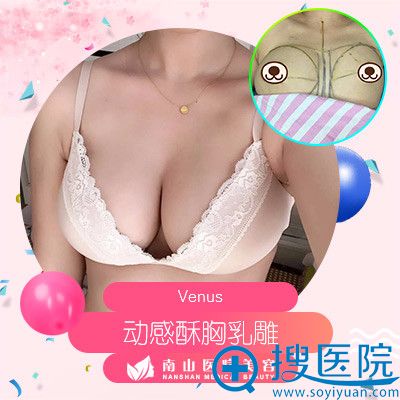 上海南山整形美容卢立新假体隆胸案例 上海南山整形美容卢立新假体隆胸案例