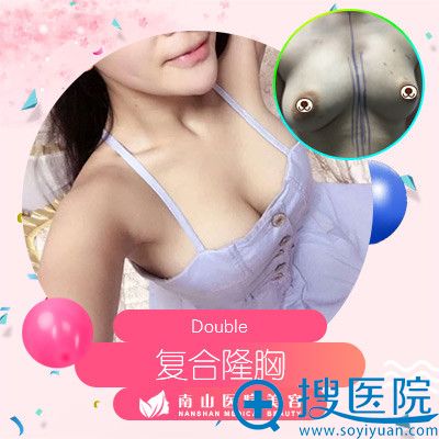 <!--<i data=20240710 data-id=2340></i>-->医生刘记整形怎么样?看复合隆胸案例效果图 <!--<i data=20240710 data-id=2340></i>-->医生刘记整形怎么样?看复合隆胸案例效果图