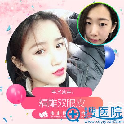 上海南山整形美容医院怎么样?看卢立新医生做的双眼皮案例 上海南山整形美容医院怎么样?看卢立新医生做的双眼皮案例