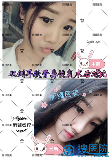 ���ϳ�ɳ�������ҽ������ҽԺ¡�ǰ���Ч��ͼ