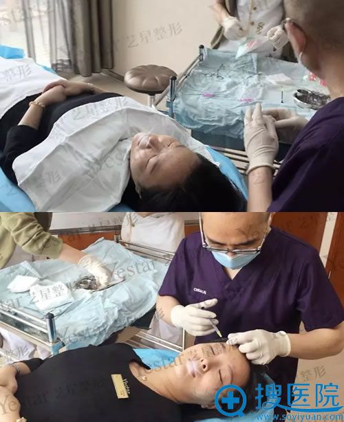 合肥艺兴陈凯院长线雕和注射过程 合肥艺兴陈凯院长线雕和注射过程